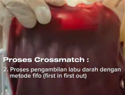 Punya Alat Crossmatch Otomatis RSUD Pandega Pangandaran Menjadi Salahsatu dari Tiga Rumah Sakit di Jawa Barat