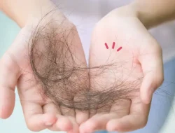 Rambut Rontok di Usia Muda, Waspadai Penyebab dan Cara Mengatasinya